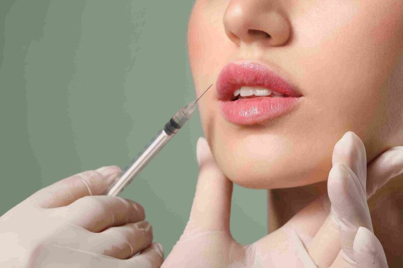 Everything You Need to Know About the Lip Flip Procedure