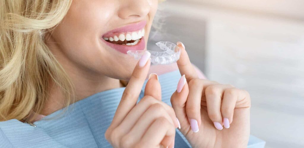 invisalign clear aligners