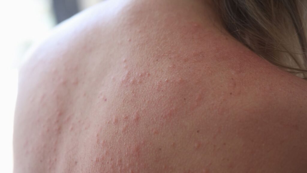 least painful body spots