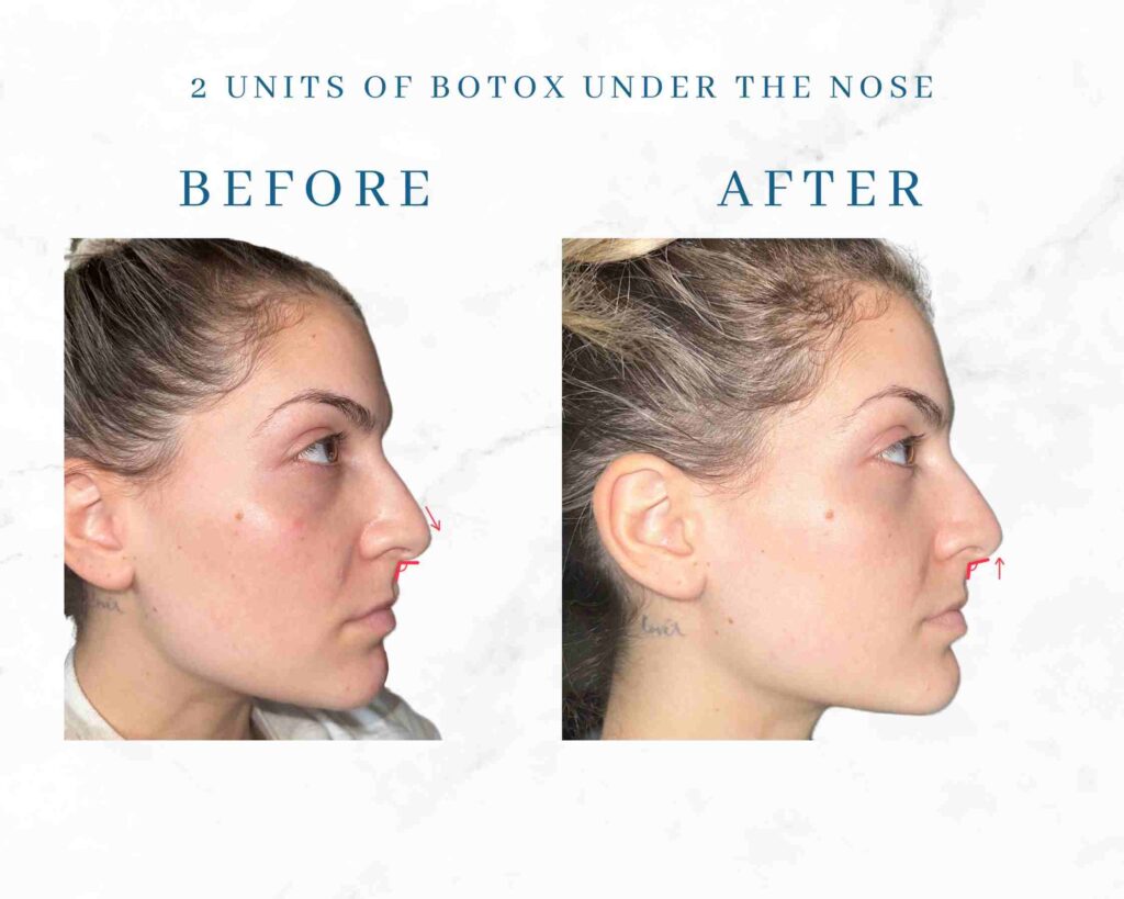 typical treatment result timelines